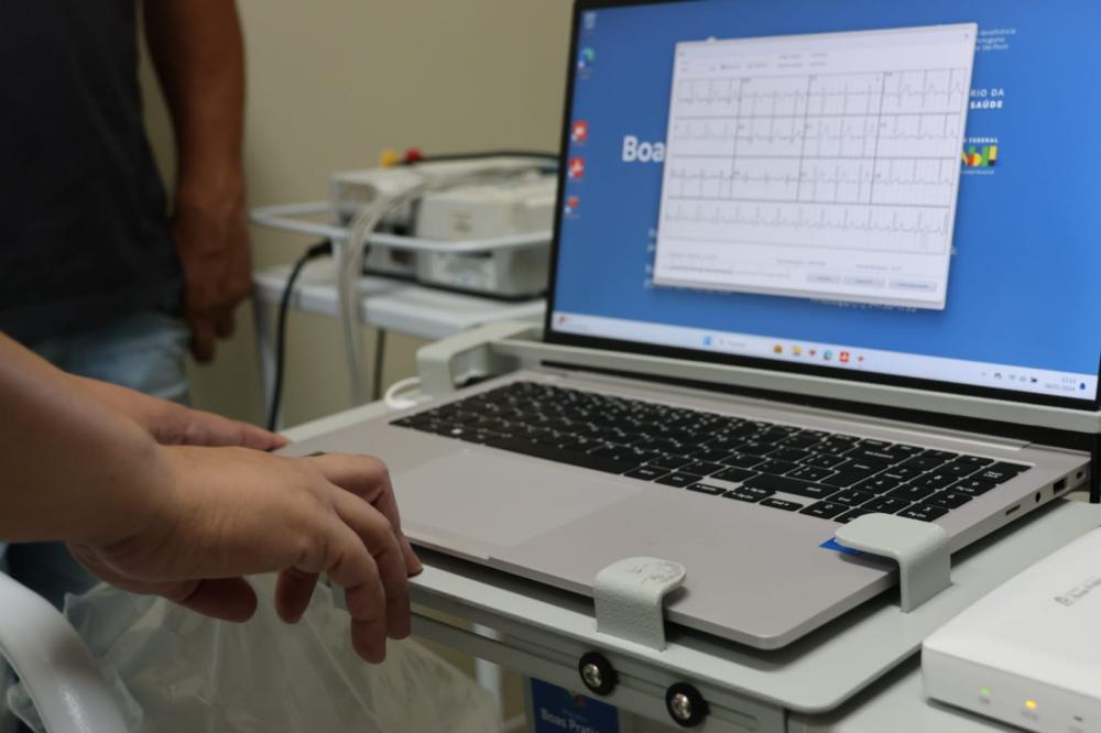 UPA de Fernandópolis ganha moderno aparelho de Eletrocardiograma 