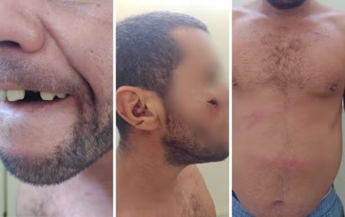 Homem é agredido por seguranças em estacionamento de supermercado