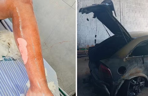 Roda de samba beneficente arrecada recursos para tratamento de pagodeiro que ficou preso em carro em chamas 
