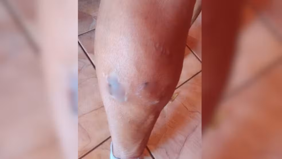 Idosa é mordida por cachorro de vizinho em Rio Preto