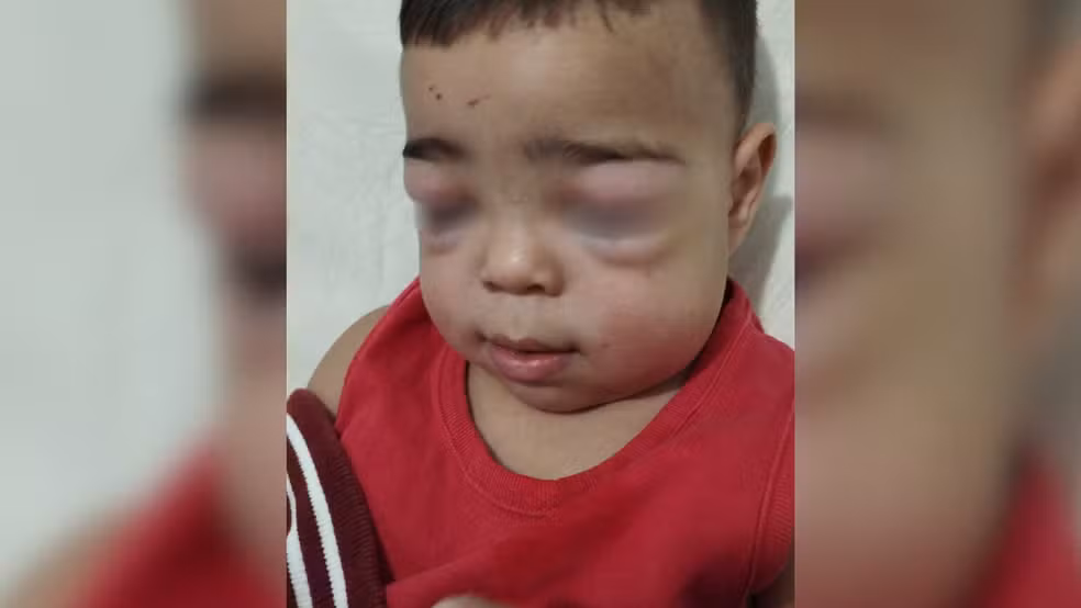 Erro médico coloca em risco a vida de criança em Andradina