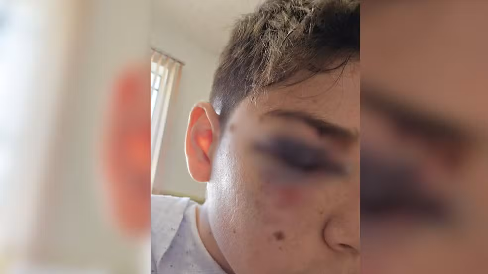 Adolescente é agredido por colega dentro de sala de aula