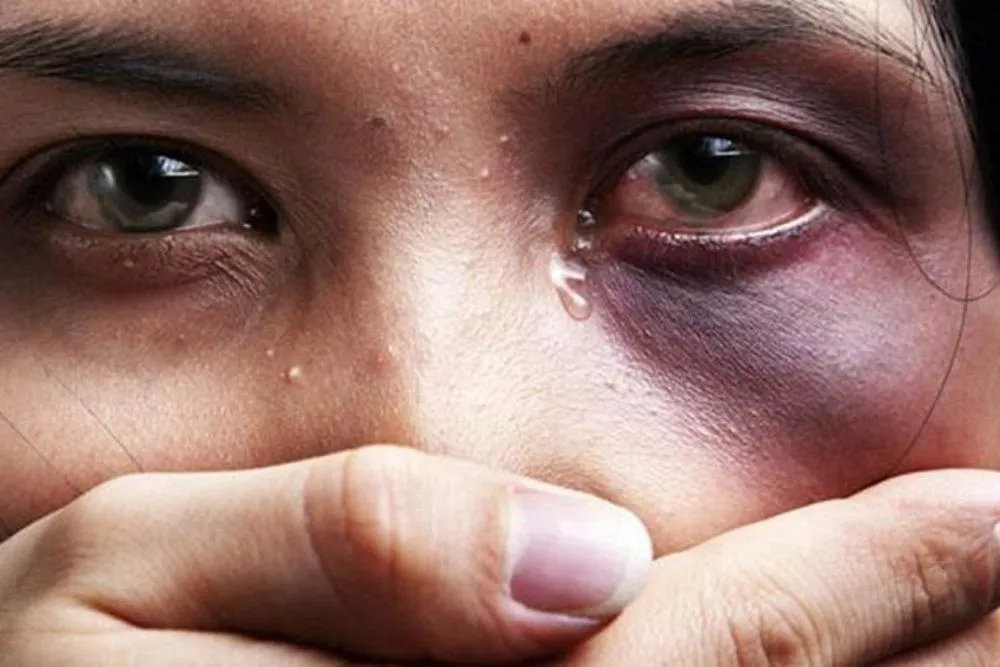 Vítima é agredida com chutes no rosto por companheiro em Rio Preto